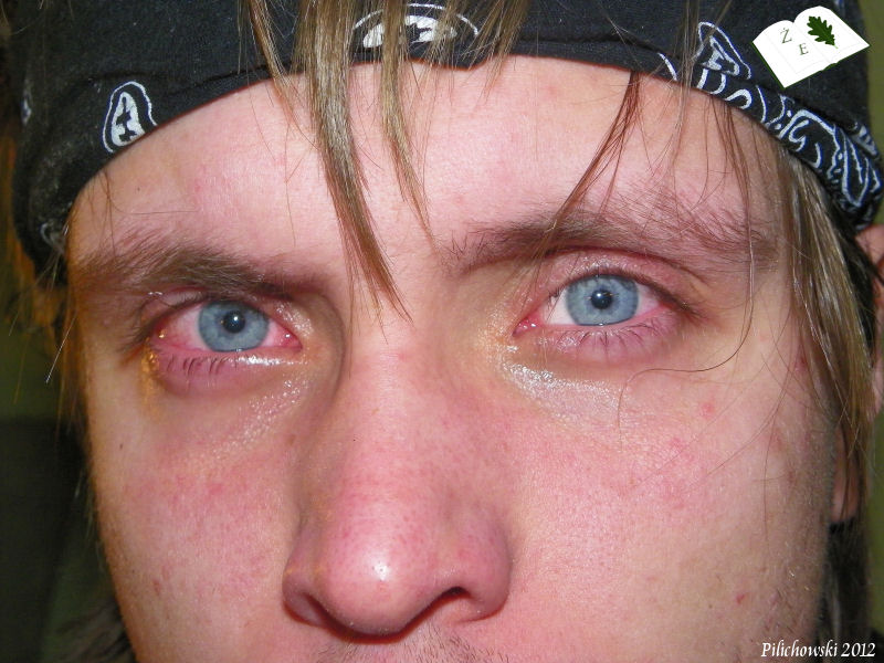 platymeris mombo oczy